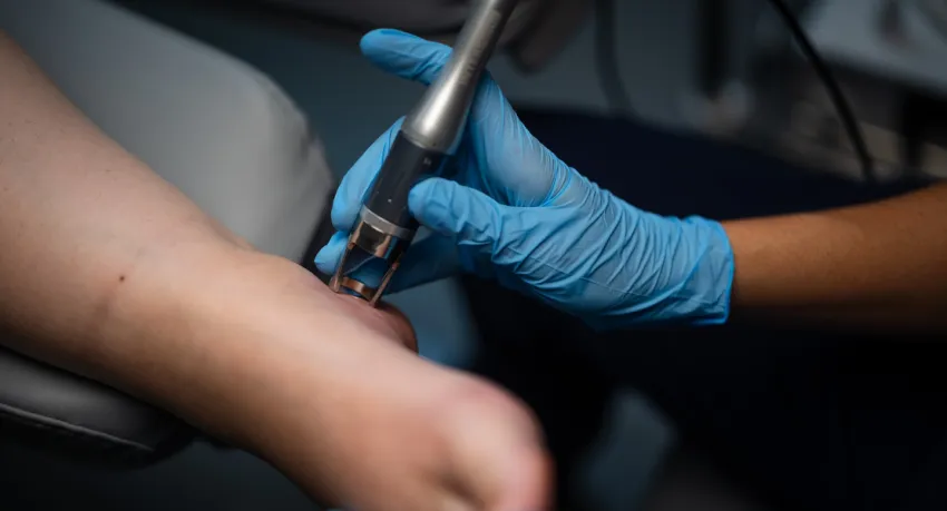 Breaking the cycle of chronic foot pain