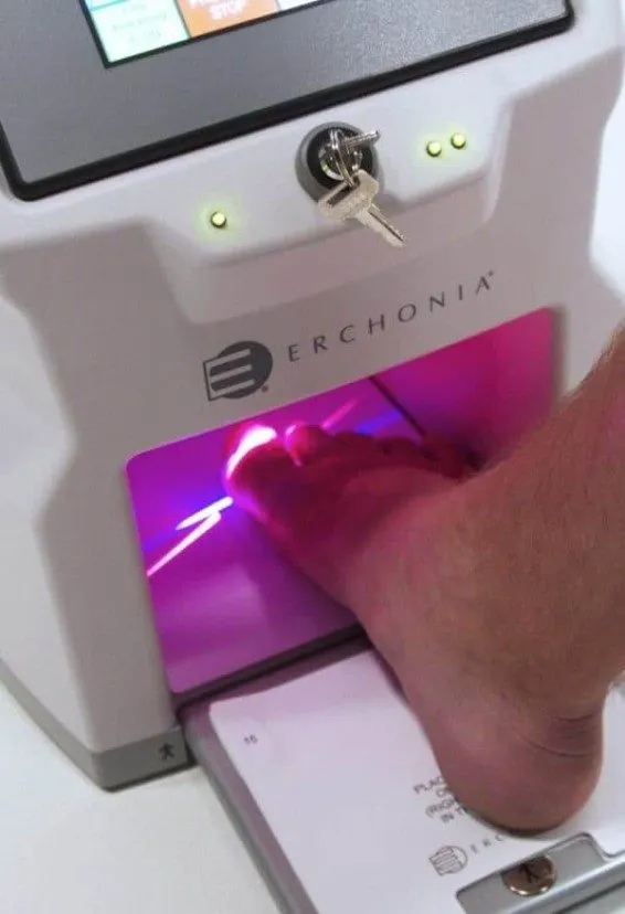 Laser Therapy At Flawless Feet