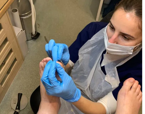 Understanding Corns and Calluses on Feet: Causes, Prevention, and Treatment