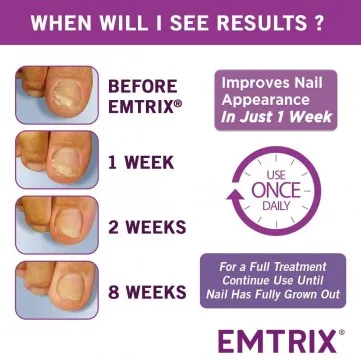Understanding Fungal Nails and the Role of Emtrix Treatment