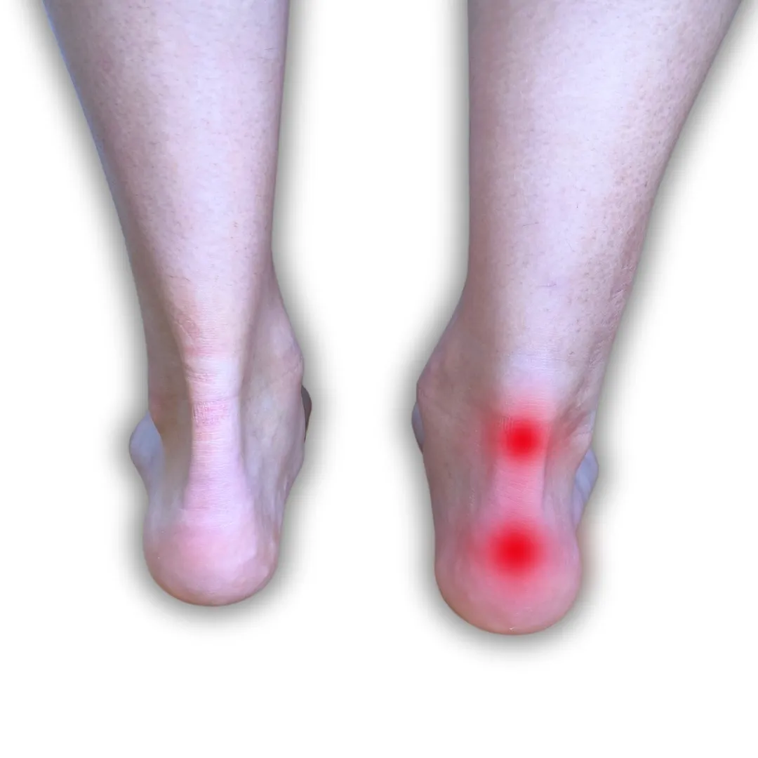 Trusted Podiatry and Chiropodists in London 