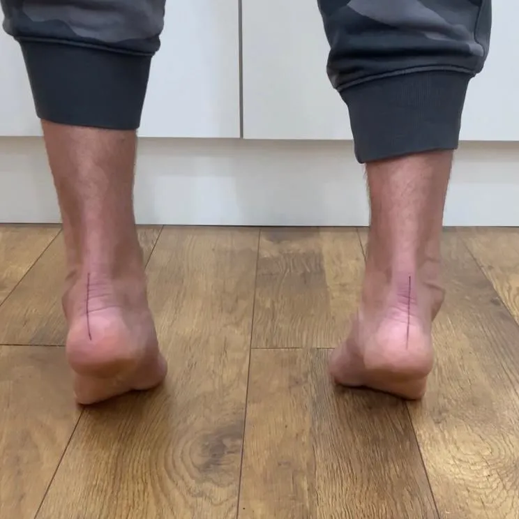 Expert Podiatry and Chiropodists in London