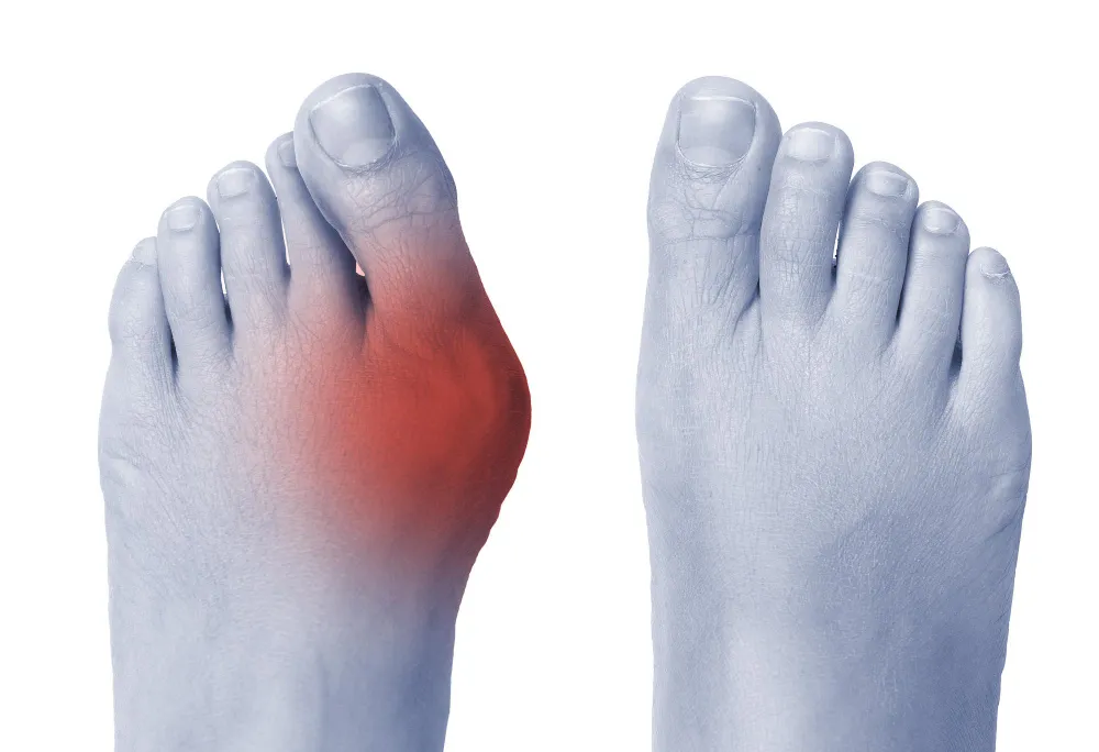 Expert Podiatry and Chiropodists in London