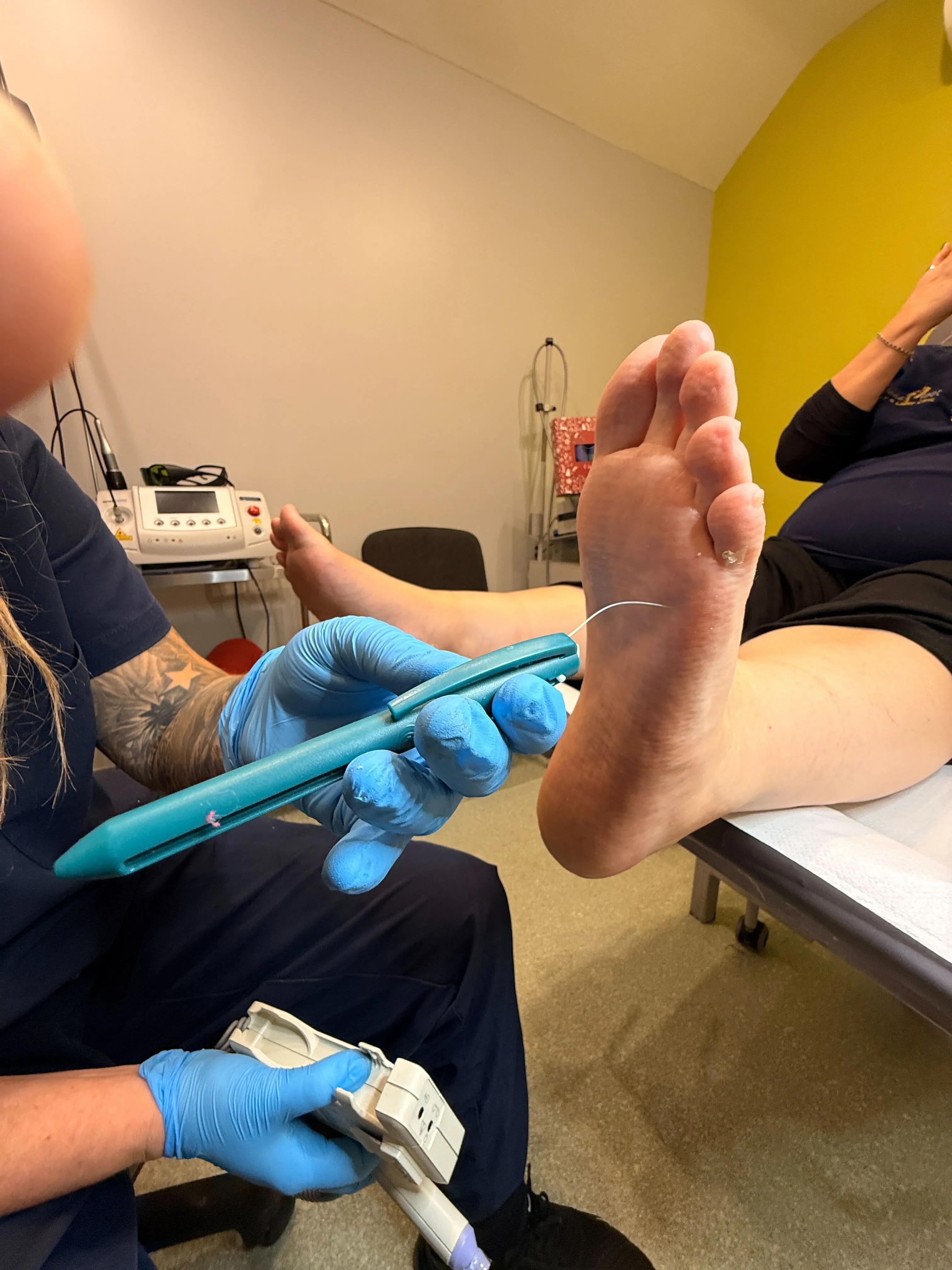 Diabetic Foot Health