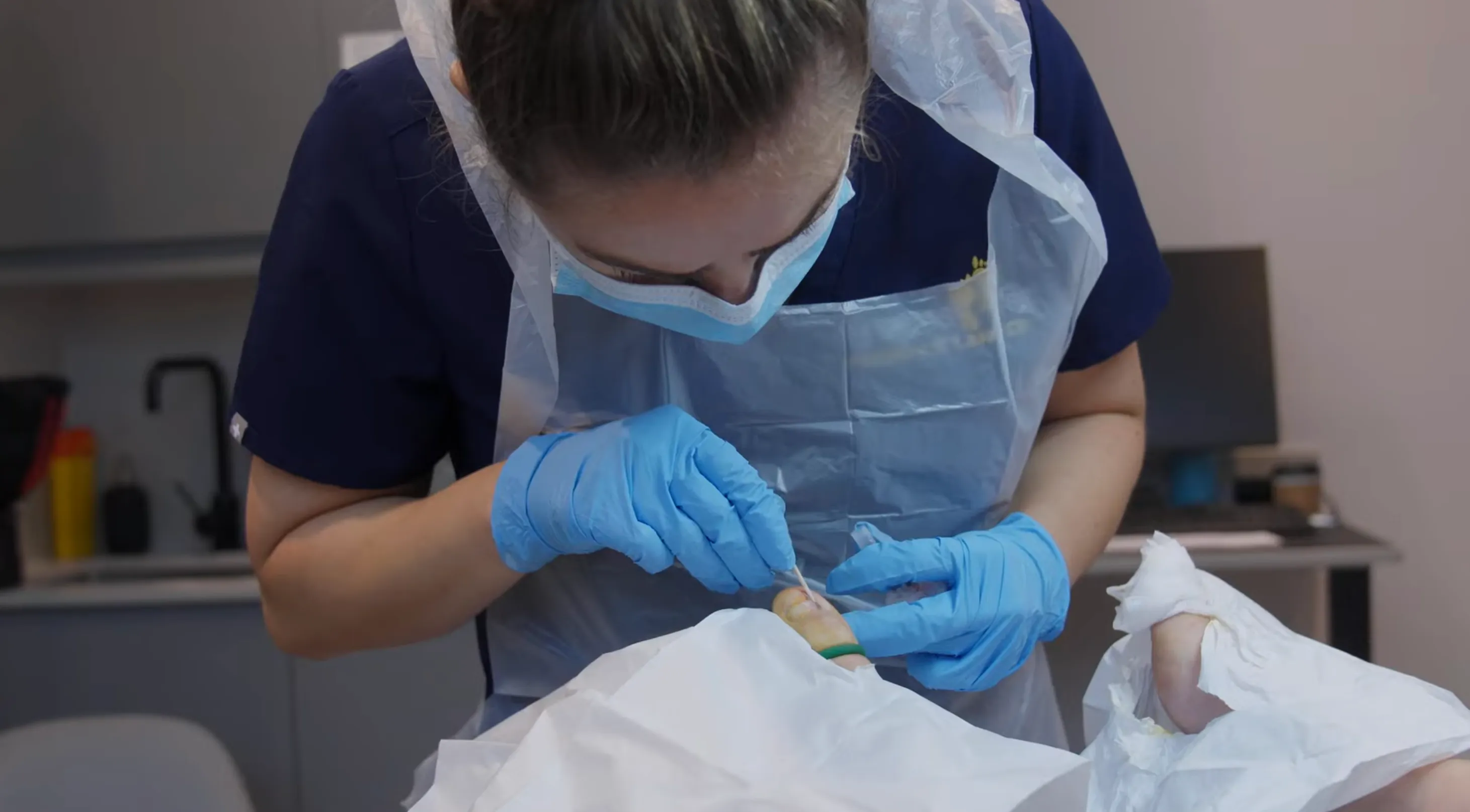 Ingrown Toenail (Onychocryptosis) – Symptoms, Causes & Diagnosis