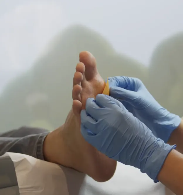 Verruca Needling Treatment Process