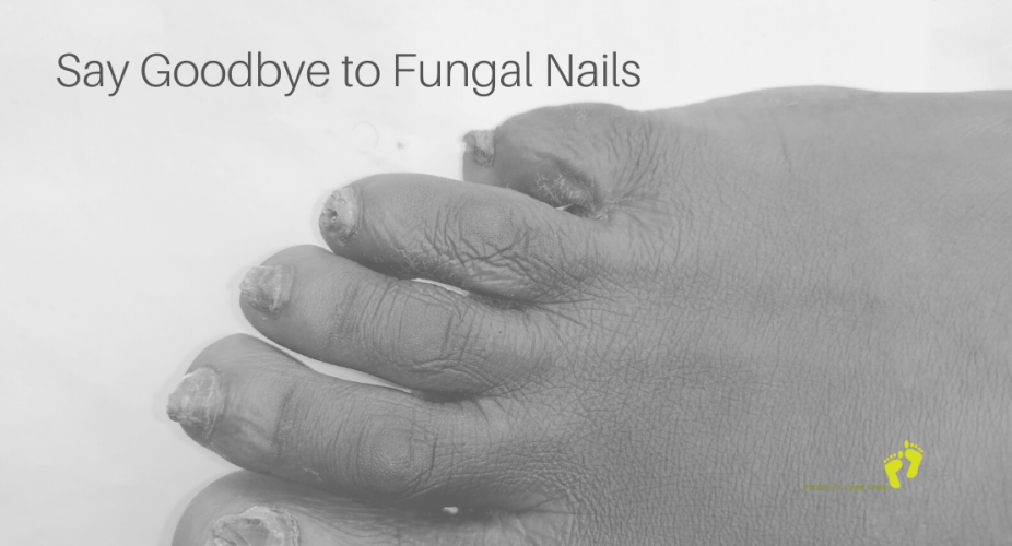 Say Goodbye to Fungal Nails: Effective Treatments for a Clear and Healthy Look